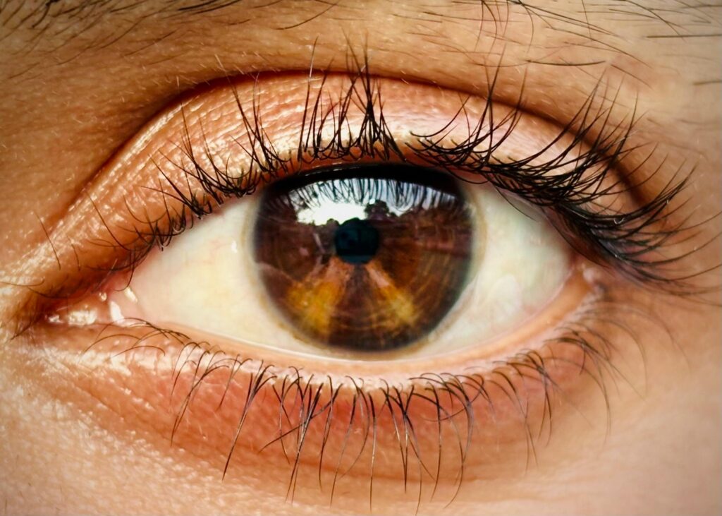 how to remove dark circles at home naturally