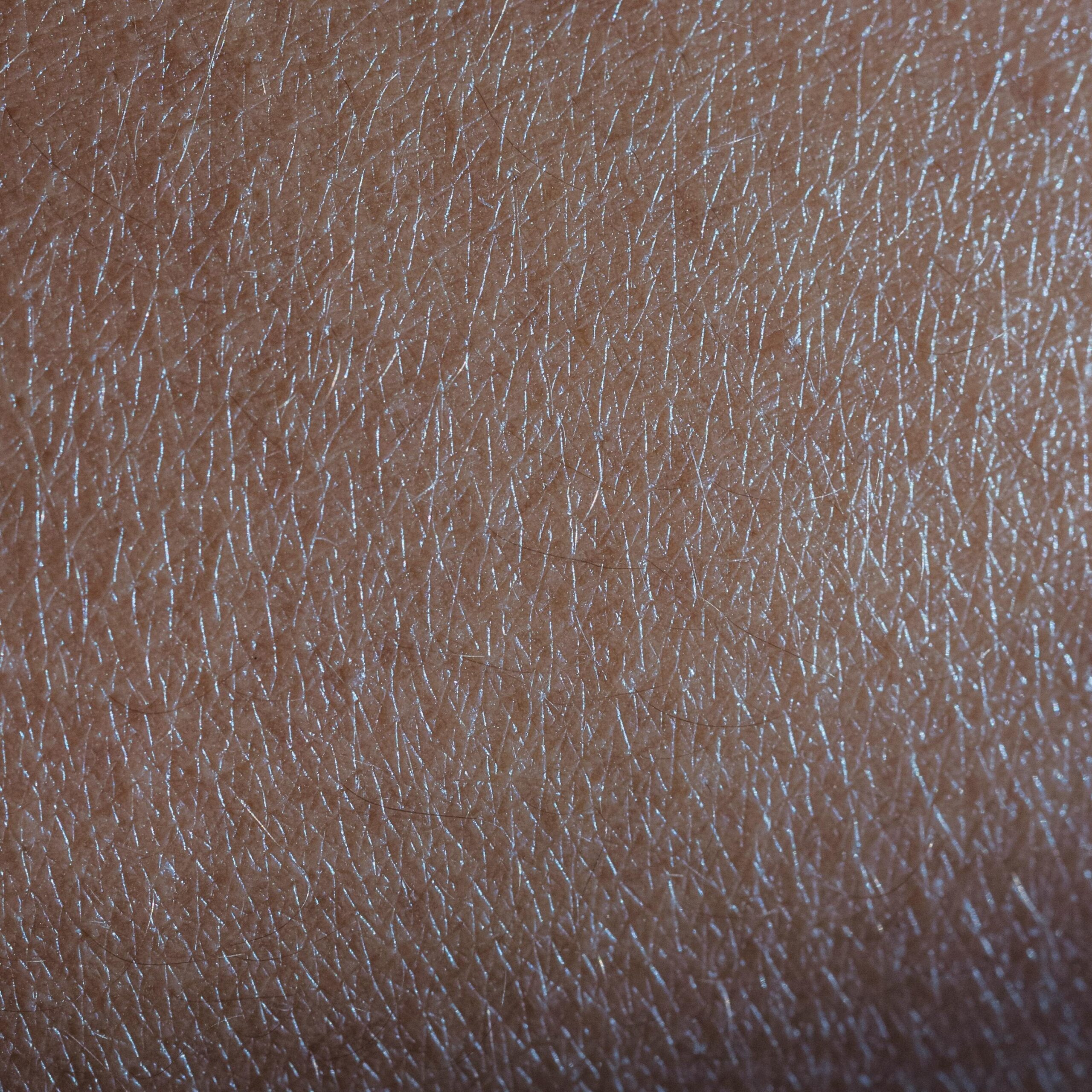 how to fix extremely dry skin during winter